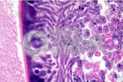 Ascaris megalocephala. Ascariasis. Male. Vas deferens. Transverse section. 500X
