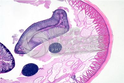 Ascaris megalocephala. Ascariasis. Male. Transverse section. 64X