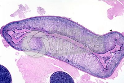 Ascaris megalocephala. Ascariasis. Male. Intestine. Transverse section. 125X