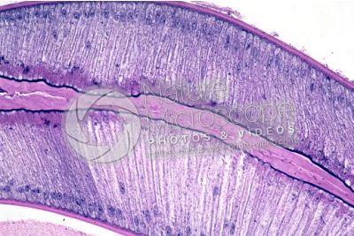Ascaris megalocephala. Ascariasis. Male. Intestine. Transverse section. 250X