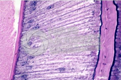 Ascaris megalocephala. Ascariasis. Male. Intestine. Transverse section. 500X