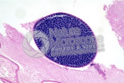 Ascaris megalocephala. Ascariasis. Male. Testis. Transverse section. 250X