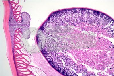 Ascaris megalocephala. Ascariasis. Male. Transverse section. 125X