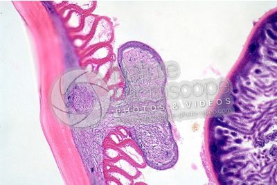 Ascaris megalocephala. Ascariasis. Male. Transverse section. 250X