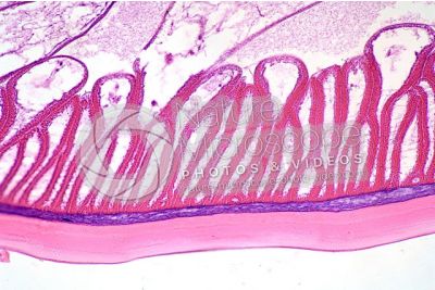 Ascaris megalocephala. Ascariasis. Male. Transverse section. 250X