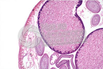 Ascaris megalocephala. Ascariasis. Female. Transverse section. 32X