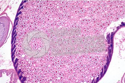 Ascaris megalocephala. Ascariasis. Female. Uterus. Transverse section. 64X