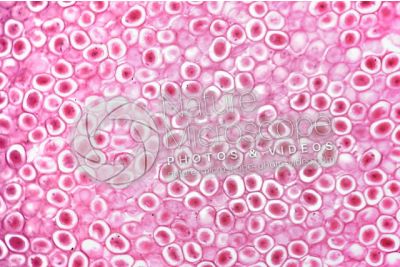 Ascaris megalocephala. Ascariasis. Female. Uterus. Transverse section. 125X