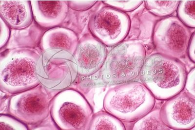 Ascaris megalocephala. Ascariasis. Female. Uterus. Transverse section. 500X