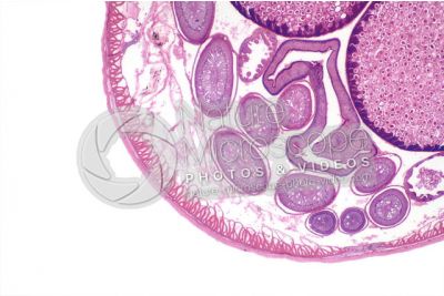 Ascaris megalocephala. Ascariasis. Female. Transverse section. 32X